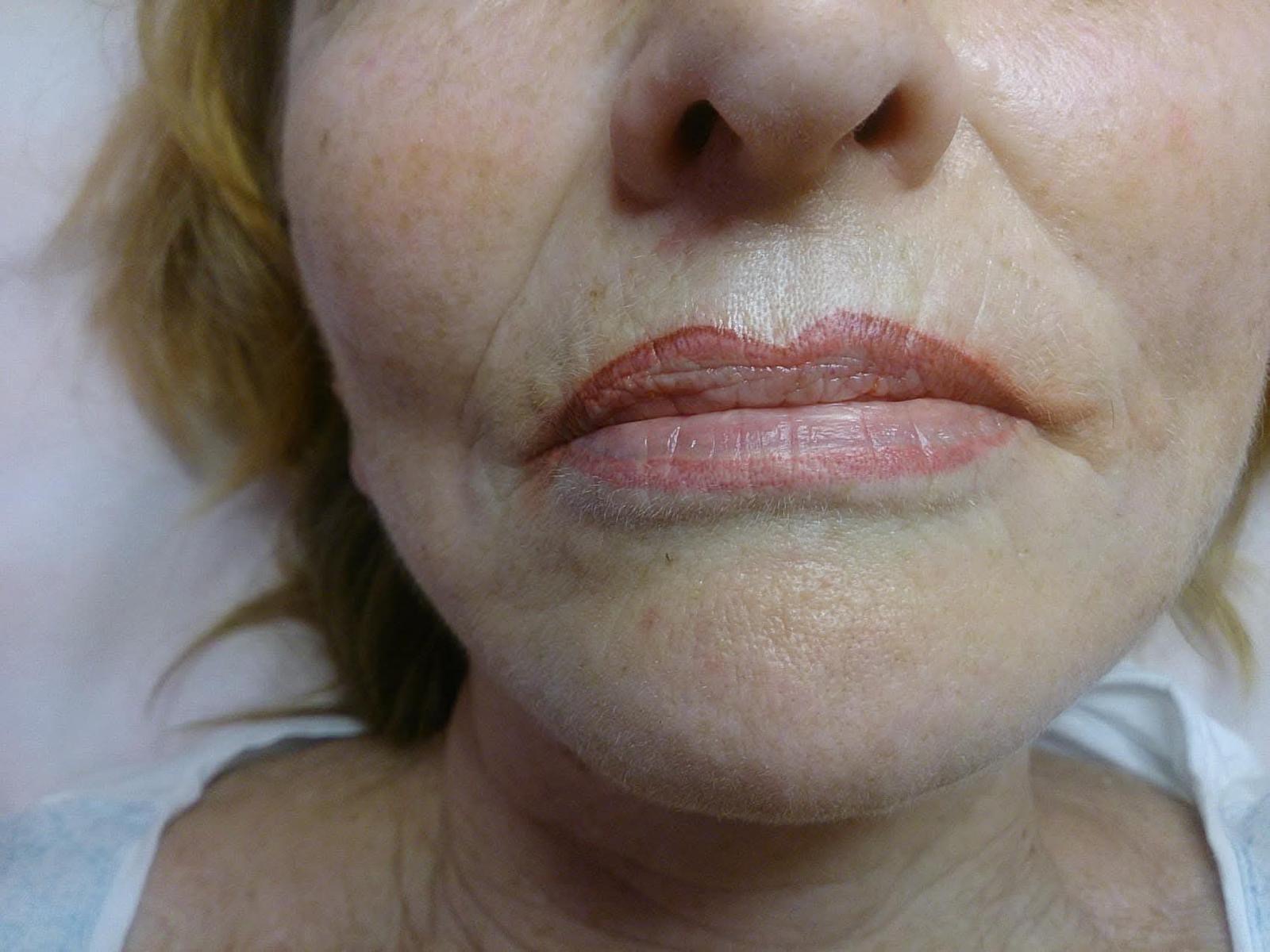 Starý permanentný make-up po 20 rokoch